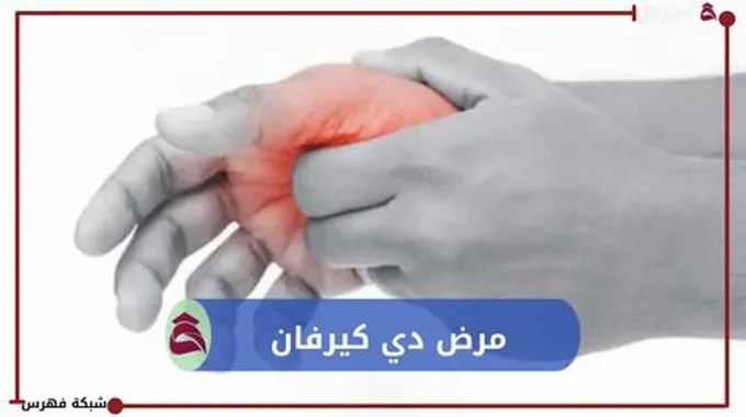 مرض دي كيرفان؛ إليك أبرز أسباب وأعراض وعلاج